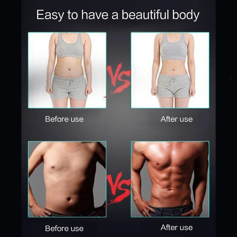 Ceinture EMS intelligente – Stimulateur musculaire